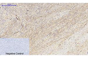 Immunohistochemical analysis of paraffin-embedded human uterus tissue. (MEK1/2 Antikörper)