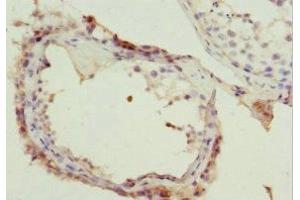 Immunohistochemistry of paraffin-embedded human testis tissue using ABIN7161740 at dilution of 1:100 (NSFL1C Antikörper  (AA 1-185))