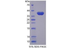 Image no. 1 for Solute Carrier Family 25 (Mitochondrial Carrier, Oxoglutarate Carrier), Member 11 (SLC25A11) (AA 1-314) protein (His tag) (ABIN5665369) (SLC25A11 Protein (AA 1-314) (His tag))