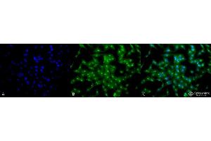 Immunocytochemistry/Immunofluorescence analysis using Rat Anti-TCP1-alpha Monoclonal Antibody, Clone 23c . (TCP1 alpha/CCTA Antikörper  (C-Term) (PE))