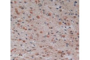 Used in DAB staining on fromalin fixed paraffin- embedded glioma tissue (GMFG Antikörper  (AA 6-126))