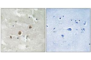 Immunohistochemical analysis of paraffin-embedded human brain tissue using MAP3K1 (Phospho-Thr1400) antibody (left)or the same antibody preincubated with blocking peptide (right). (MAP3K1 Antikörper  (pThr1402))