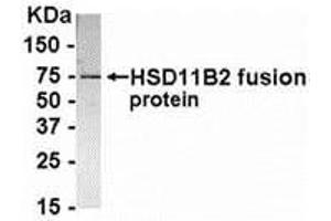Western Blotting (WB) image for anti-Hydroxysteroid (11-Beta) Dehydrogenase 2 (HSD11B2) (AA 181-405) antibody (ABIN2468177) (HSD11B2 Antikörper  (AA 181-405))