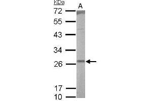 WB Image RALA antibody detects RALA protein by Western blot analysis.
