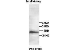 Western blot analysis of fetal kidney lysate, using AADACL2 antibody. (AADACL2 Antikörper  (AA 171-378))