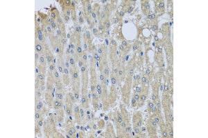 Immunohistochemistry of paraffin-embedded human liver injury using SYT11 antibody. (SYT11 Antikörper  (AA 37-200))