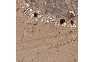 Immunohistochemical staining of human cerebellum with MLF1IP polyclonal antibody  shows strong cytoplasmic and nuclear positivity in Purkinje cells at 1:50-1:200 dilution. (MLF1IP Antikörper)