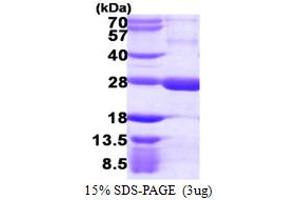 SDS-PAGE (SDS) image for Regulator of G-Protein Signaling 5 (RGS5) (AA 1-181) protein (His tag) (ABIN667524)