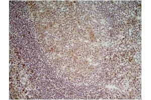 Immunohistochemistry (Frozen Sections) (IHC (fro)) image for anti-CD70 Molecule (CD70) antibody (ABIN316748) (CD70 Antikörper)