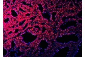 IF analysis of RBM15B using anti-RBM15B antibody (ABIN7600219).