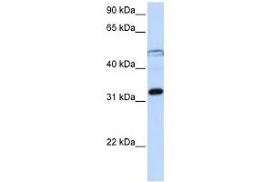 EIF3G antibody used at 1 ug/ml to detect target protein. (EIF3G Antikörper  (Middle Region))