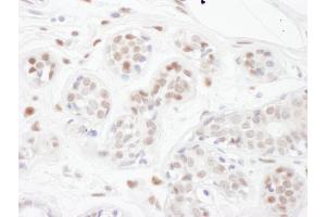 Immunohistochemistry (IHC) image for anti-PIN2/TERF1 Interacting, Telomerase Inhibitor 1 (PINX1) (AA 225-275) antibody (ABIN7455029)