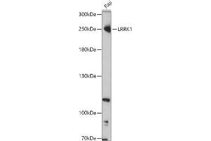 Western blot analysis of extracts of Raji cells, using LRRK1 antibody (ABIN7268231) at 1:1000 dilution. (LRRK1 Antikörper  (AA 10-90))
