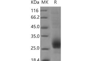 Western Blotting (WB) image for CD79b Molecule, Immunoglobulin-Associated beta (CD79B) protein (His tag) (ABIN7321125)