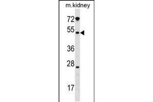 Western blot analysis in mouse kidney tissue lysates (35ug/lane).