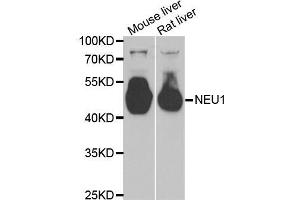 Western blot analysis of extracts of various tissues, using NEU1 antibody (ABIN5973721) at 1/1000 dilution. (NEU1 Antikörper)