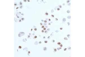 Immunocytochemistry (ICC) image for anti-Proliferating Cell Nuclear Antigen (PCNA) (AA 225-261) antibody (ABIN7449543)