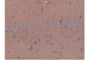 IHC-P analysis of Rat Brain Tissue, with DAB staining. (Aquaporin 4 Antikörper  (AA 179-314))