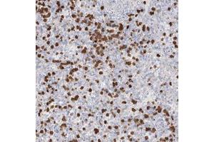 Immunohistochemical staining of human spleen with ZNF227 polyclonal antibody  shows strong cytoplasmic positivity in subsets of cells in red pulp at 1:500-1:100 dilution. (ZNF227 Antikörper)