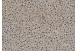 ABIN6278774 at 1/100 staining Rat liver tissue by IHC-P. (TPD52L3 Antikörper  (N-Term))