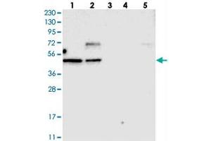 Western blot analysis of Lane 1: RT-4, Lane 2: U-251 MG, Lane 3: Human Plasma, Lane 4: Liver, Lane 5: Tonsil with TOX polyclonal antibody . (TOX Antikörper)