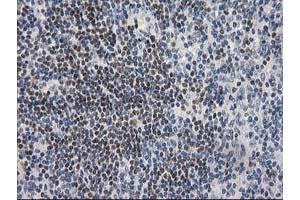 Immunohistochemistry (IHC) image for anti-ADP-Ribosylation Factor GTPase Activating Protein 1 (ARFGAP1) antibody (ABIN1496680) (ARFGAP1 Antikörper)