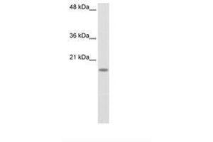 Image no. 1 for anti-Ribosomal Protein S14 (RPS14) (C-Term) antibody (ABIN203014) (RPS14 Antikörper  (C-Term))