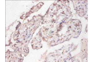 Immunohistochemistry (IHC) image for anti-Cytochrome B5 Reductase 3 (CYB5R3) (AA 1-301) antibody (ABIN7160982)