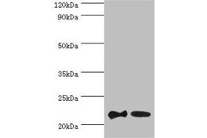 Western blot All lanes: SRI antibody at 2 μg/mL Lane 1: HepG2 whole cell lysate Lane 2: Hela whole cell lysate Secondary Goat polyclonal to rabbit at 1/10000 dilution Predicted band size: 22, 21 kDa Observed band size: 22 kDa (SRI Antikörper  (AA 1-198))