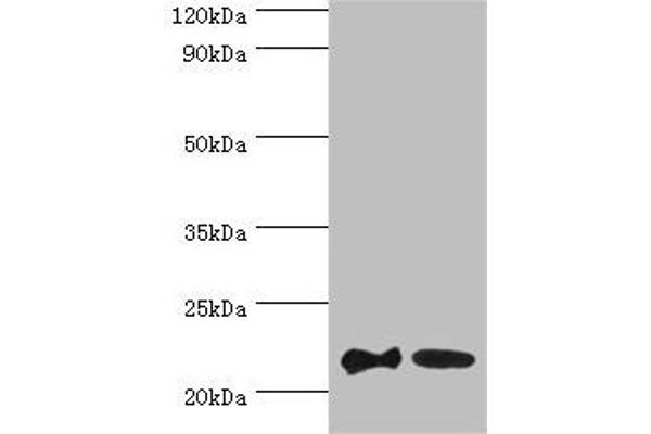 SRI Antikörper  (AA 1-198)