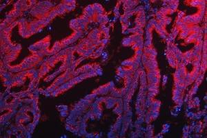 IF analysis of TTC7B using anti-TTC7B antibody (ABIN7601050). (TTC7B Antikörper  (AA 275-730))