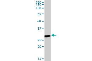 ANP32B MaxPab polyclonal antibody. (ANP32B Antikörper  (AA 1-251))