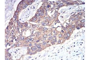 Immunohistochemistry (IHC) image for anti-RAB1B, Member RAS Oncogene Family (RAB1B) (AA 60-201) antibody (ABIN5542373)