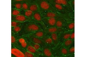 IF analysis of TRIM36 using anti-TRIM36 antibody (ABIN7600059) and anti-Tubulin Alpha antibody (ABIN7600339).