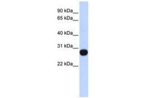 Image no. 1 for anti-Transcription Elongation Factor A (SII)-Like 4 (TCEAL4) (AA 107-156) antibody (ABIN6741080) (TCEAL4 Antikörper  (AA 107-156))