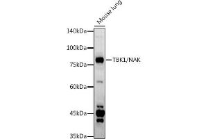 Western blot analysis of extracts of Mouse lung, using TBK1/NAK antibody (ABIN3016267, ABIN3016268, ABIN3016269 and ABIN6219678) at 1:1000 dilution. (TBK1 Antikörper  (AA 440-729))