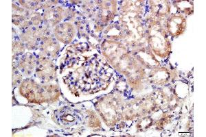 Formalin-fixed and paraffin embedded rat kidney labeled with Rabbit Anti-NTCP/SLC10A1 Polyclonal Antibody, Unconjugated  at 1:200 followed by conjugation to the secondary antibody and DAB staining (SLC10A1 Antikörper  (AA 21-120))