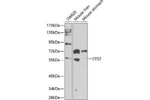 Western blot analysis of extracts of various cell lines, using CES2 antibody (ABIN6134283, ABIN6138436, ABIN6138437 and ABIN6217717) at 1:1000 dilution. (CES2 Antikörper  (AA 310-410))