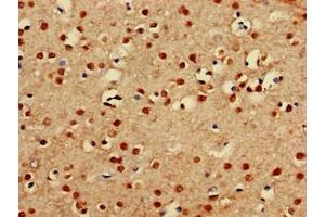 Immunohistochemistry of paraffin-embedded human brain tissue using ABIN7164089 at dilution of 1:100 (PRDM16 Antikörper  (AA 448-683))