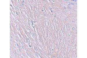 Immunohistochemical staining of human brain cells with SYNPO polyclonal antibody  at 2. (SYNPO Antikörper  (C-Term))
