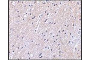 Immunohistochemical staining of human brain tissue using AP30592PU-N at 2. (SLC9A1 Antikörper  (Center))