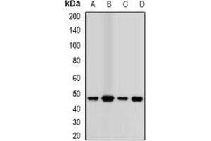 Western blot analysis of Transcobalamin-2 expression in MCF7 (A), A549 (B), mouse kidney (C), mouse lung (D) whole cell lysates. (TCN2 Antikörper)