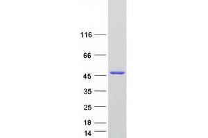 Western Blotting (WB) image for Snurportin 1 (SNUPN) (Transcript Variant 3) protein (Myc-DYKDDDDK Tag) (ABIN2732325)
