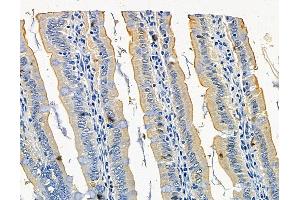ABIN7096351 and ABIN7100413 at 1/100 staining rat colorectal tissue by IHC-P.