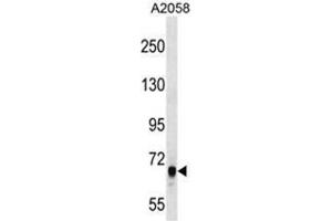 ARHGEF5 Antibody (C-term) western blot analysis in A2058 cell line lysates (35µg/lane). (ARHGEF5 Antikörper  (C-Term))