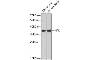 Western blot analysis of extracts of various cell lines using NPL Polyclonal Antibody at dilution of 1:3000. (NPL Antikörper)