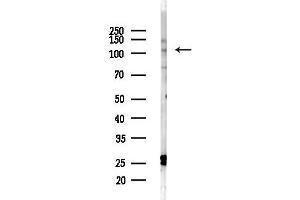 anti-KIAA0753 (KIAA0753) antibody