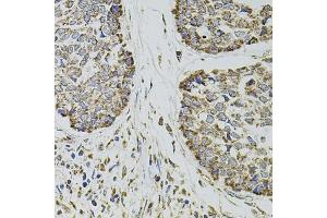 Immunohistochemistry (IHC) image for anti-Selectin P (Granule Membrane Protein 140kDa, Antigen CD62) (SELP) (AA 30-200) antibody (ABIN6147503)