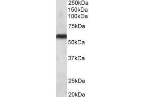 Western Blotting (WB) image for anti-Cytochrome P450, Family 2, Subfamily C, Polypeptide 8 (CYP2C8) (Internal Region) antibody (ABIN870642)