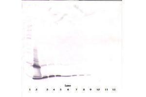 Image no. 2 for anti-PDGF-BB Homodimer antibody (ABIN465589) (PDGF-BB Homodimer Antikörper)
